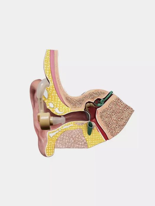 Eshitish aparati - Cyber Sonic Sound Amplifier