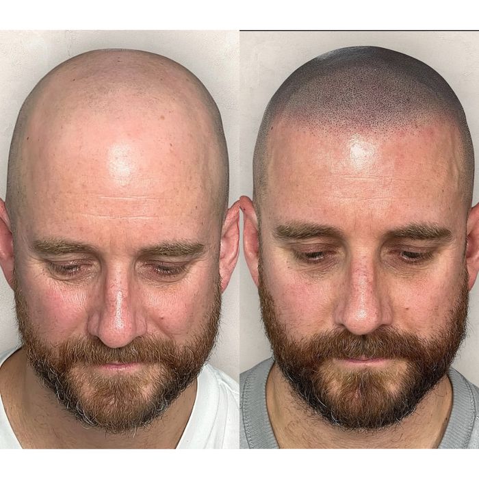 Micropigmentare barba scalp sprancene barbati Bucuresti