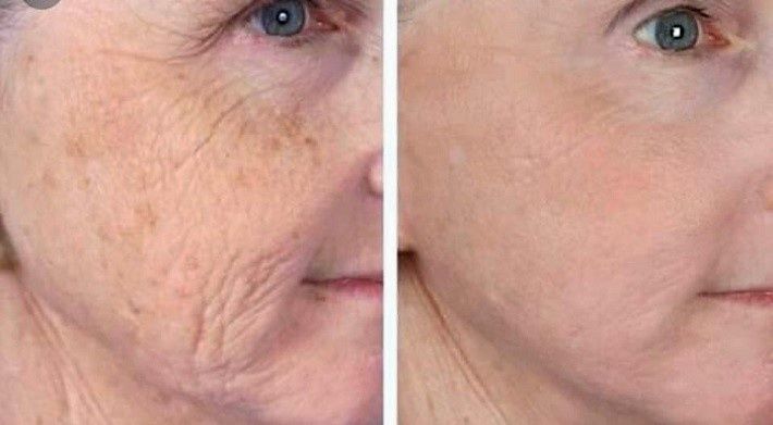 Продам плазма ручку