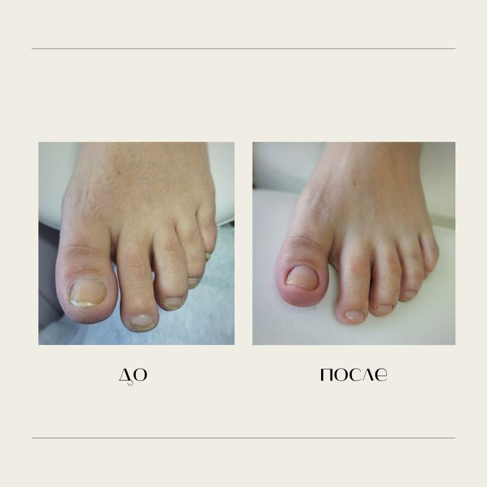 Педикюр, подолог