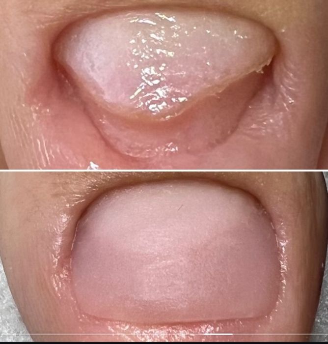 Подология лечение стоп и ногтей