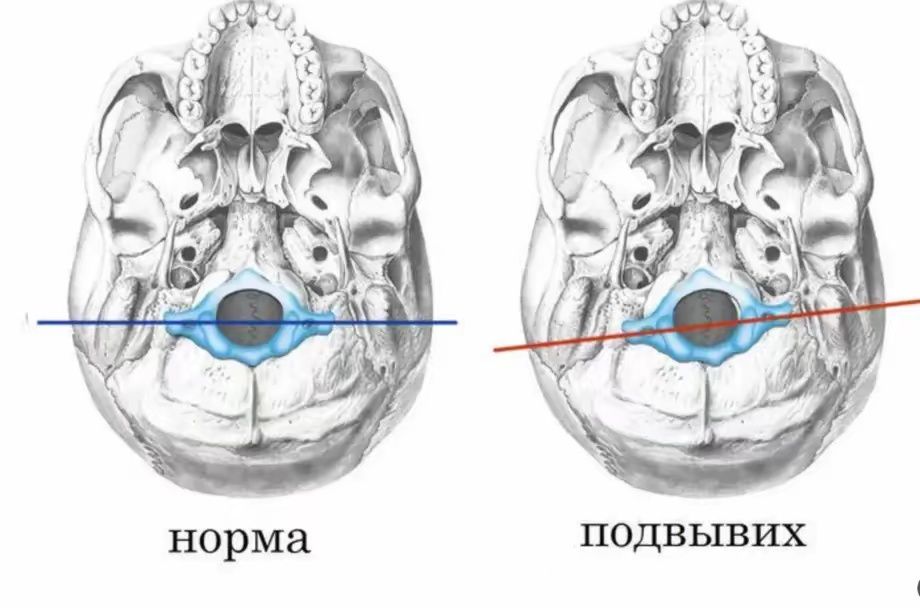 Массаж миофасциальный