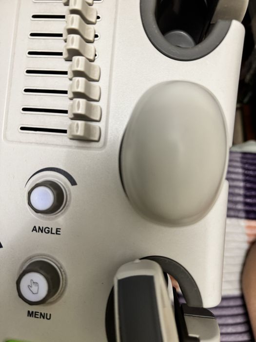 Узи аппарат SonoScape SSI 8000