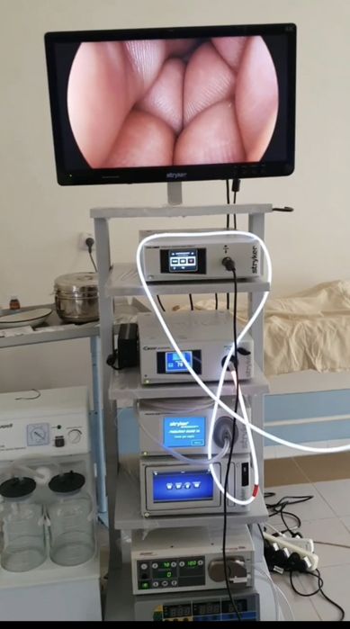 STRYKER 1588 4K. 30.000$