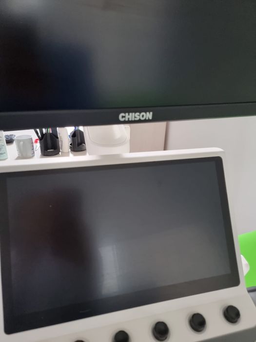 Узи аппарат Chison