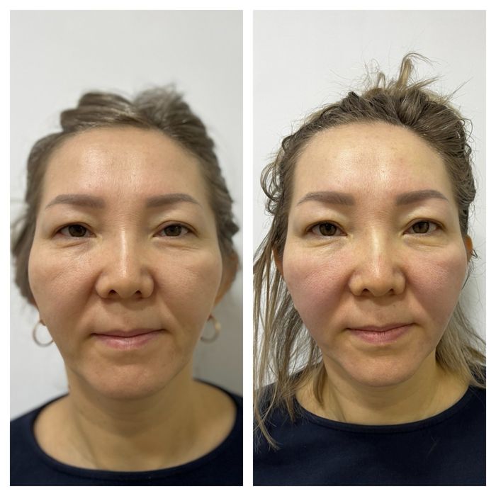 Массаж лица в Караганде