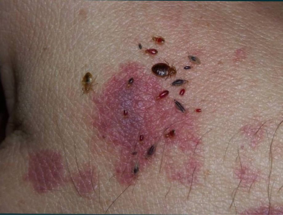 Скидка 20% Дезенфекция дизенфекция дезинфекция дизинфекция dizinfeksiy