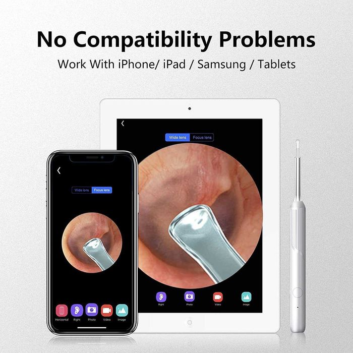 Смарт WiFi отоскоп Sheealthub