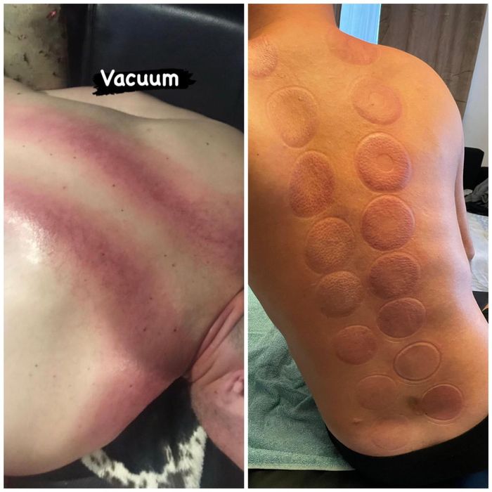 Kinetoterapie la domiciliu