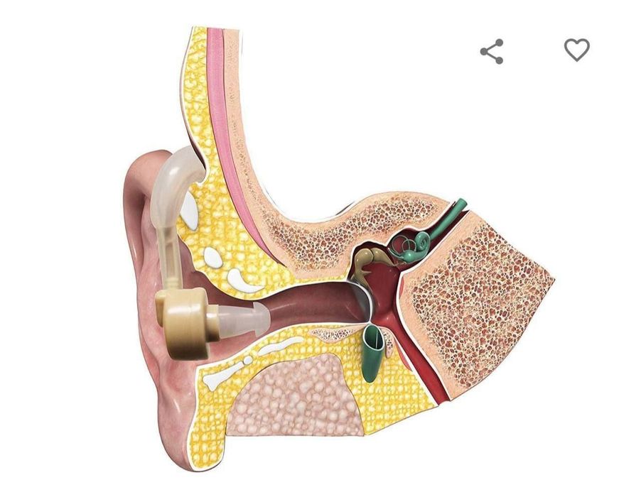 Syber Sonic Sound Amplifier quloqdagi nuqson uchun