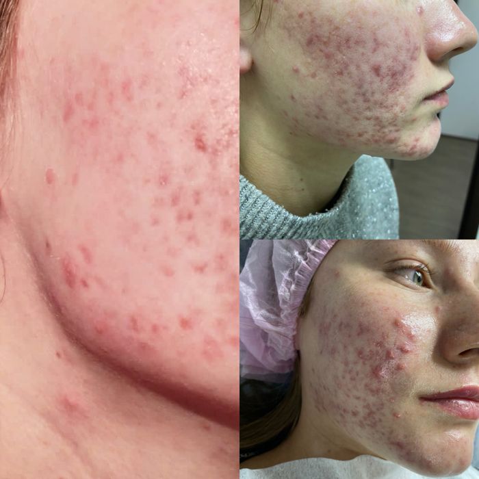 Скидки на косметологические услуги