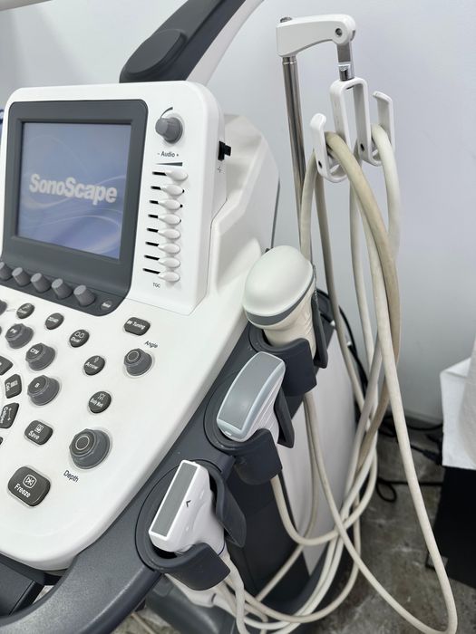 Продам УЗИ аппарат