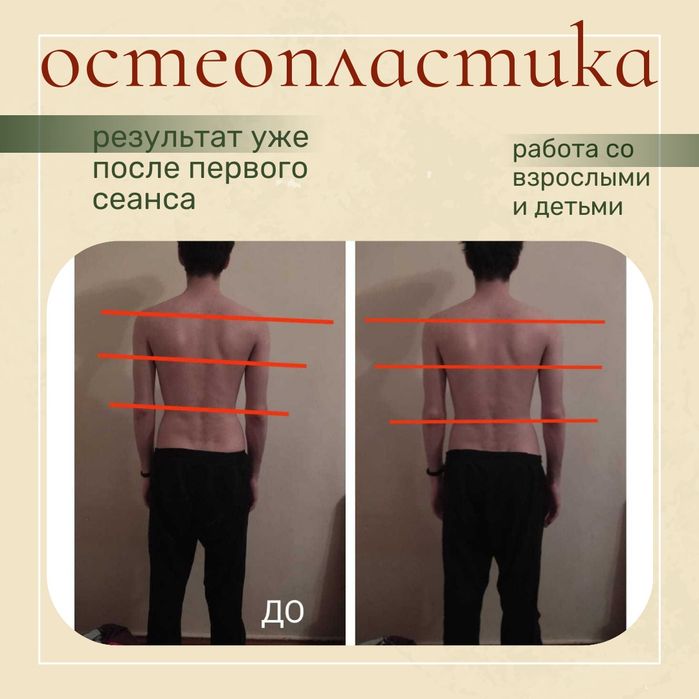 Остеопластический массаж