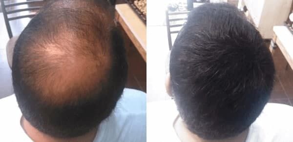 Soch soqol uchun yangilik