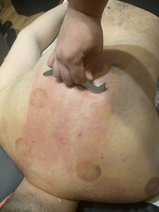 Chiropractică/Masaj/Ventuze/Kineto