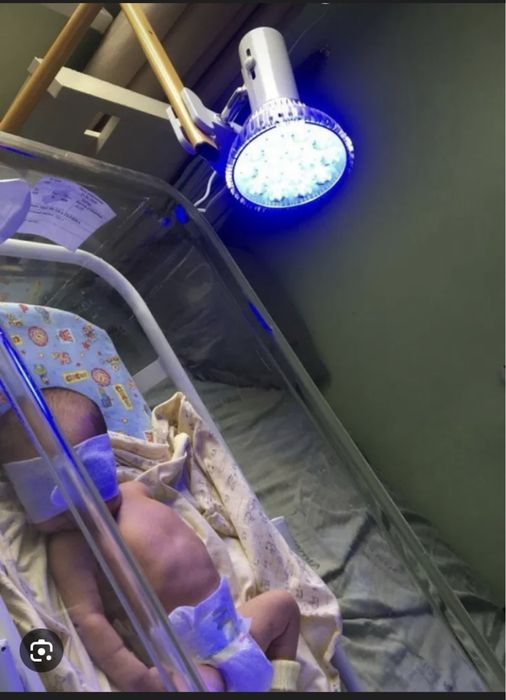 Фотолампа от желтушки продам