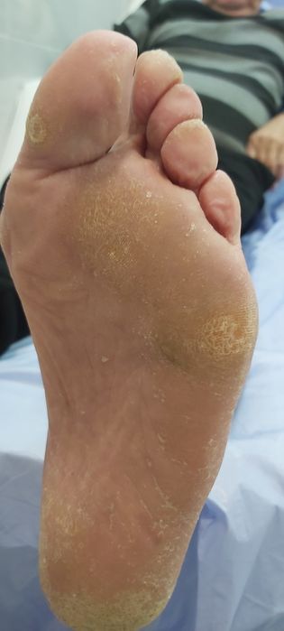 Pedichiura Kart Oradea