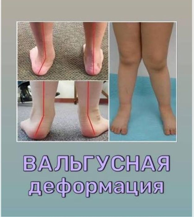 Балалар массажы !!!