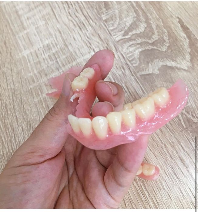 Съёмные протезы,зубные протезы,починки ремонт протеза