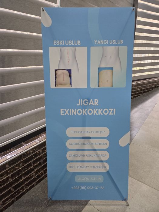 Рекламный Паук (X-стенд) – переносная стойка для размещения информации