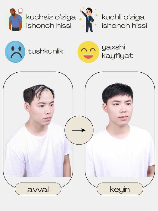 Erkaklar uchun parik, Мужской протез волос, парик