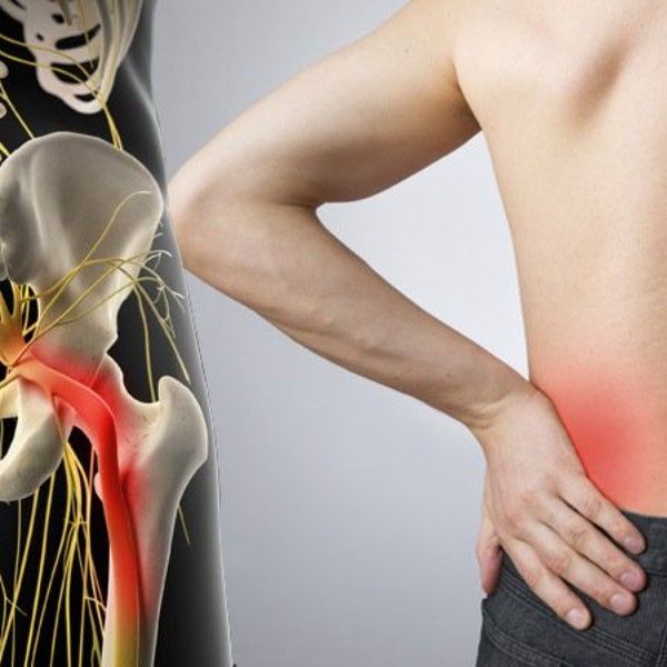 Седалищный нерв, гайморит лечение, хиджама