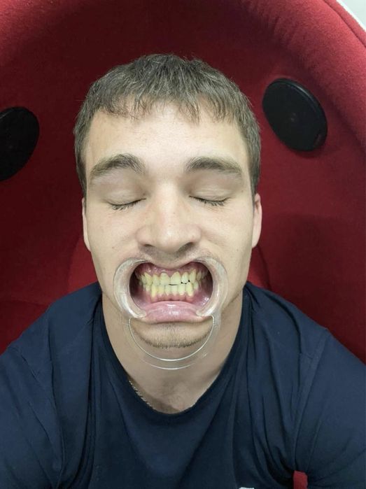 Бизнес с ДОХОДОМ ОТ МИЛЛИОНА в месяц отбеливание зубов