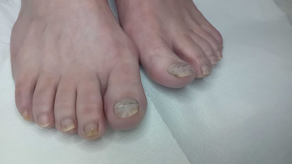 Podologica Pedichiura complexa