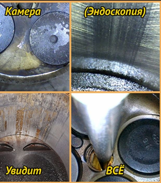 Эндоскопия эндоскоп