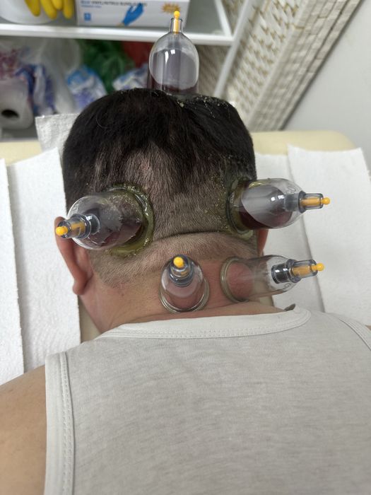 Хиджама Астана хиджама в астане