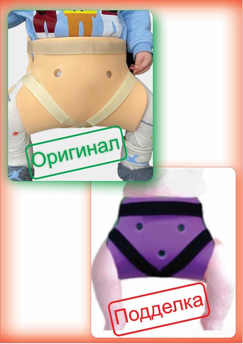 Chaqaloqlar uchun Shina freyka ( Displaziya )