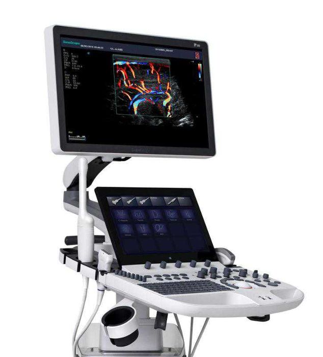 Аппарат УЗИ P50 Elite "SonoScape"