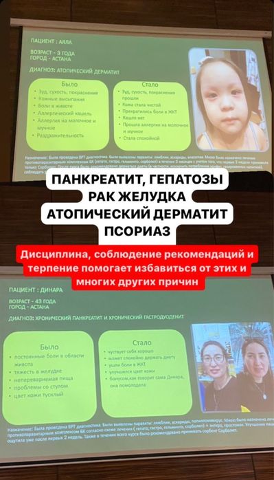 Бальзамы Короткова