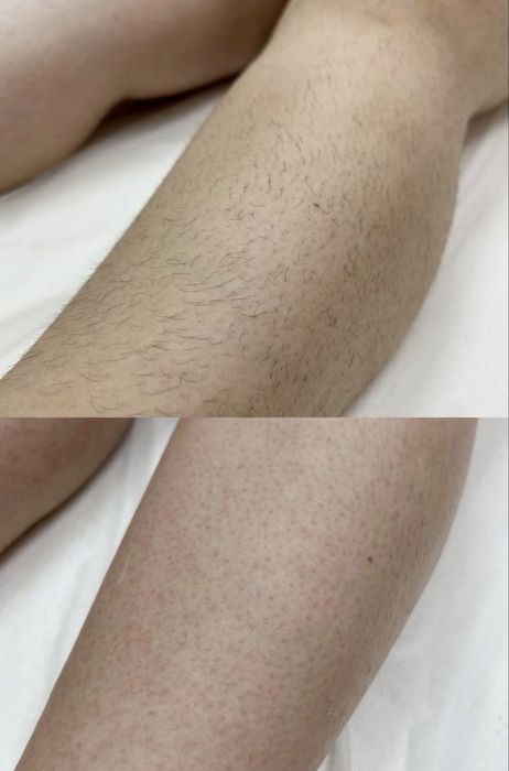 Шугаринг/депиляция/Чирчик только женщины!