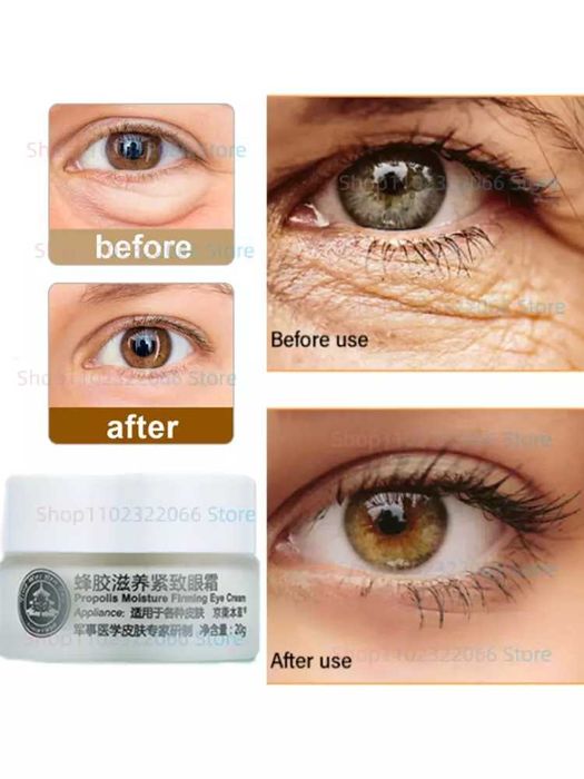 Ko'z atrofidagi ajinlar va osilgan terini yoshartiruvchi krem