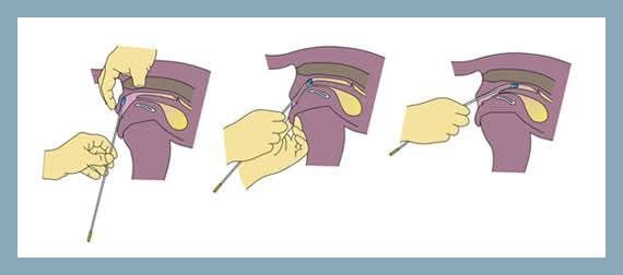 Inseminare artificiala - monta artificiala caini