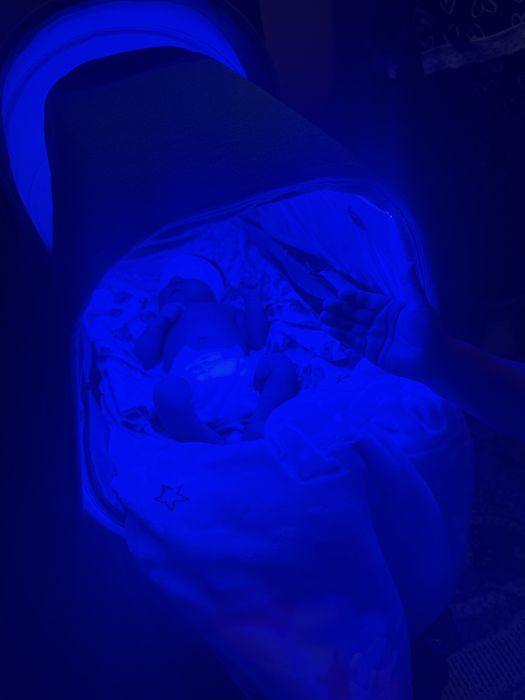 Фотолампа от желтушки