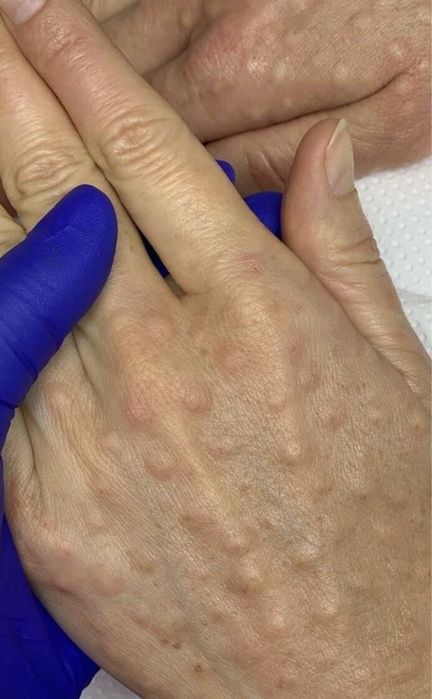 Косметолог скидка на всё в честь Рамадан и 8 марта!