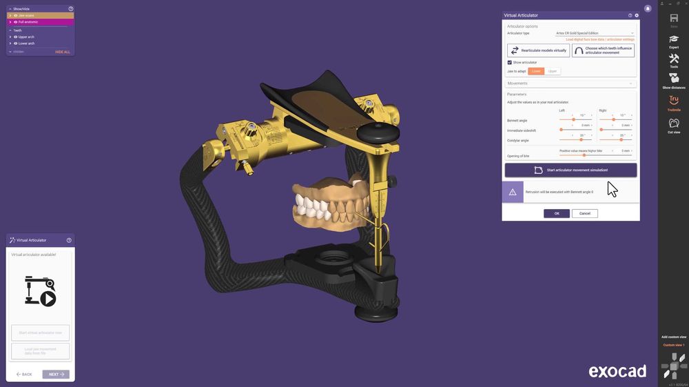 EXOCAD 3.3 Chemnitz + PartialCAD ​​3.3 + ExoPlan 3.1 + B4D iBar