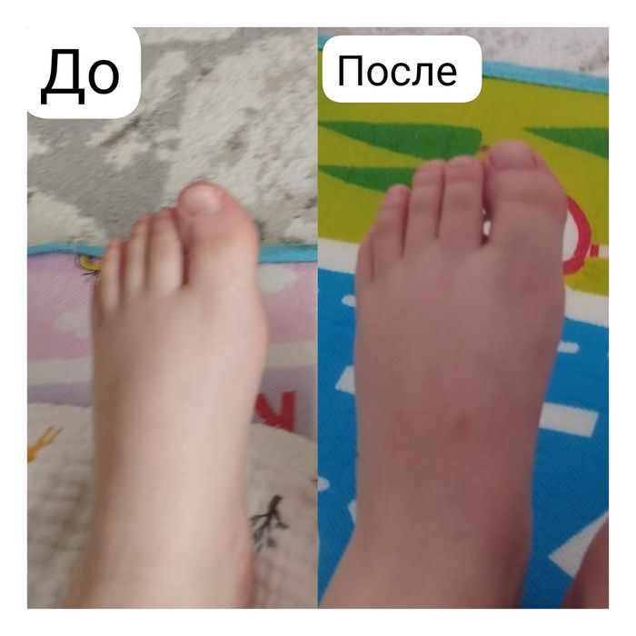 Емдік сауықтыру массажы
