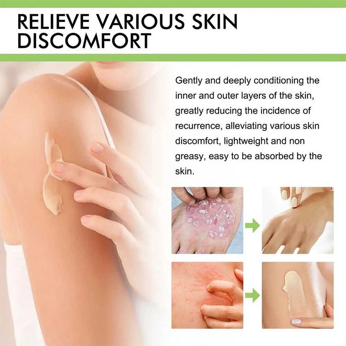 ZB Healmusz*2 bucati-Crema psoriazis, dermatita, prurit, antibacterian