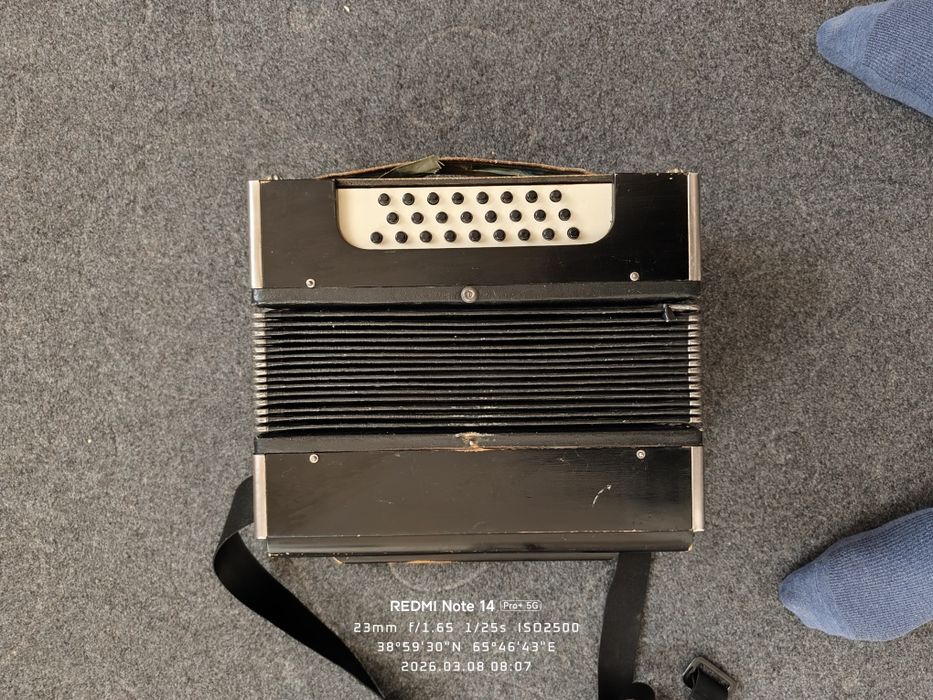 Akardion ishlashi zor umuman aybi yuq