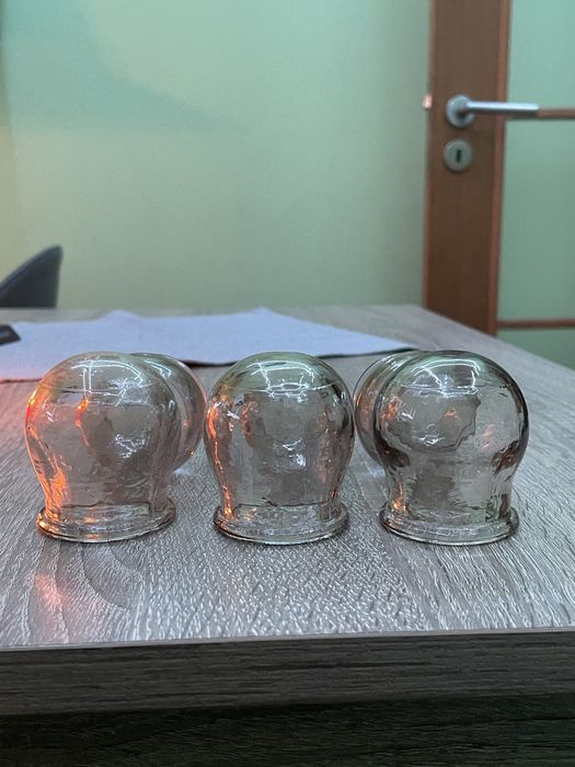 Стъклени вендузи