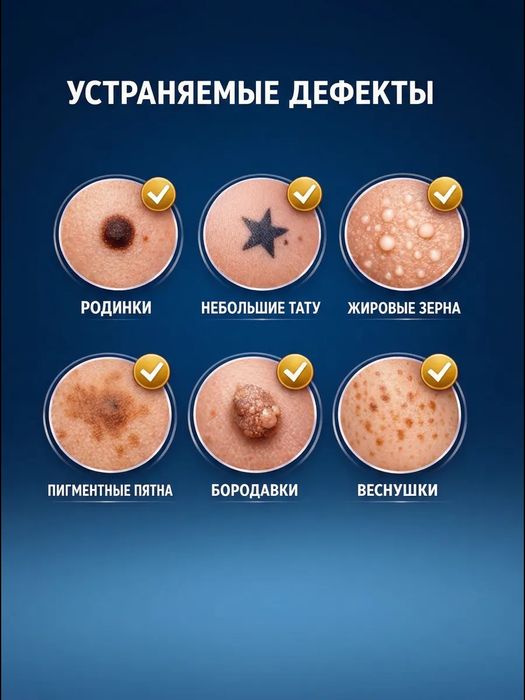 Косметический аппарат для удаления папиллом и бородавок. Коагулятор