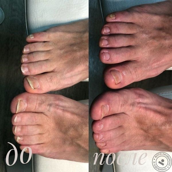 Мужской эстетический маникюр и педикюр куйлюк