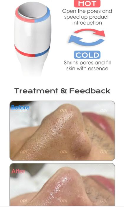 Hidradermabraziune Aparat cosmetic profesional  exfoliere