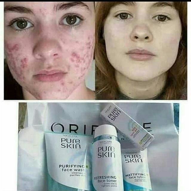 Òzingizga mehr kòrsating