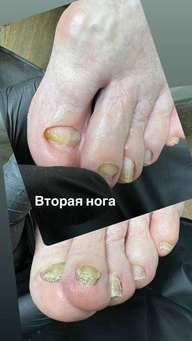 Подолог, Маникюр, Педикюр