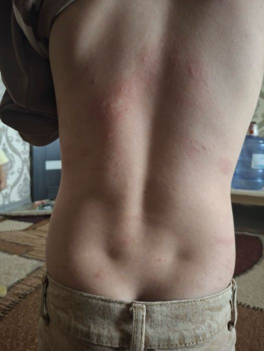 Dezinfeksiya dezinseksiya deratizatsiya xizmati 24/7