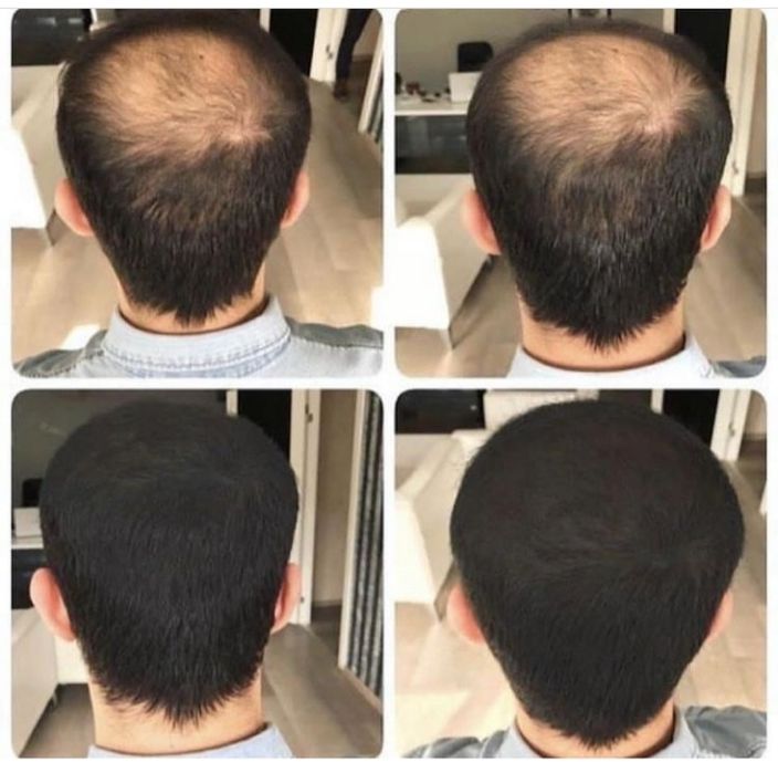 Eng muhimi ishonchli sotuv Toppik загуститель